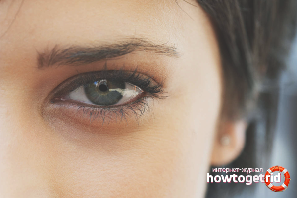 Comment se débarrasser des sacs sous les yeux