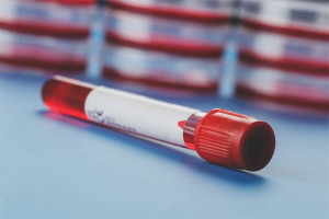 Comment augmenter l'hémoglobine pendant la grossesse