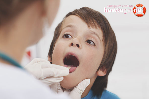 How to treat a sore throat