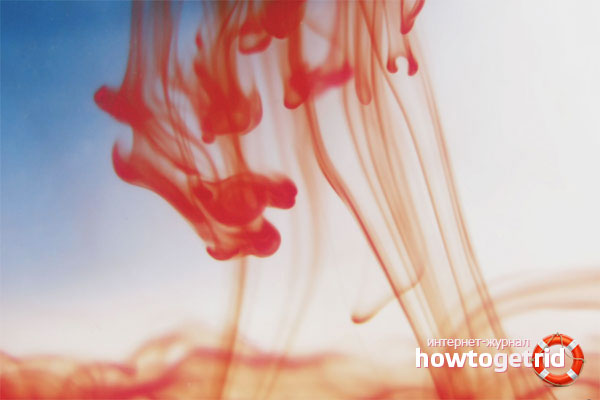 Blutungsursachen im zweiten Schwangerschaftstrimester