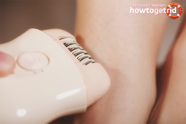 Elektrischer Epilierer