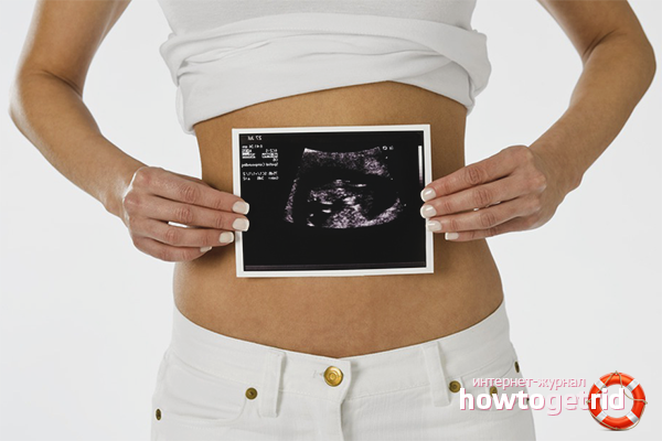 Avoiding a first trimester miscarriage
