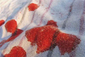 How to wash dried blood