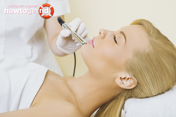 So entfernen Sie Kapillaren im Gesicht im Büro der Kosmetikerin