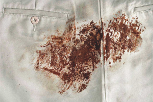 How to remove a chocolate stain