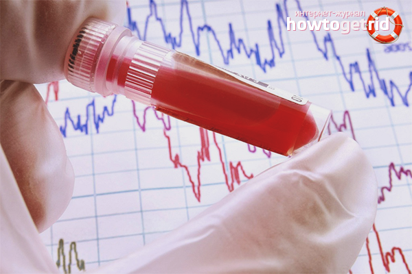 Comment faire baisser la bilirubine dans le sang