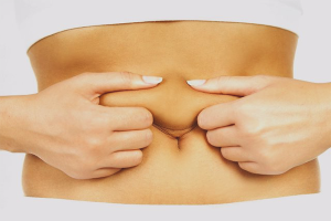 How to tighten the skin on the stomach after childbirth