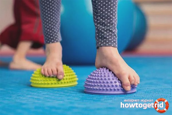 Therapeutische Übungen gegen Plattfüße