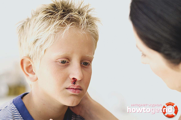 Épistaxis chez les enfants