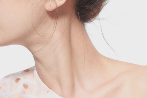 How to remove the rings of Venus on the neck