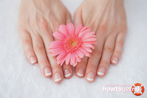 Volksheilmittel im Kampf gegen Pilze an den Händen