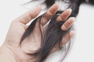 Hair loss after childbirth