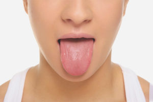 How to treat tongue sores
