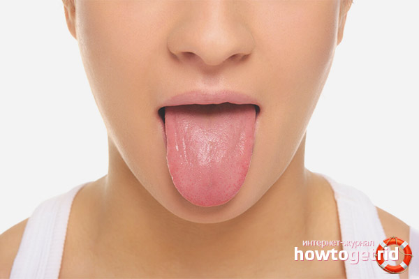 Comment traiter les plaies de la langue