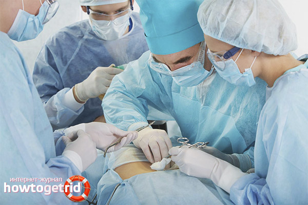 Chirurgie de l'incontinence urinaire