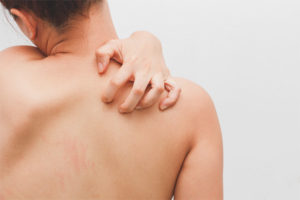 Itching throughout the body without rashes