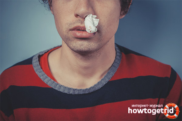 Was tun, wenn Blut aus der Nase kommt?