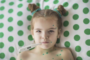 Chickenpox in children